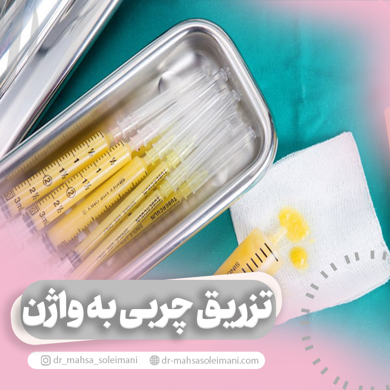 تزریق چربی به واژن