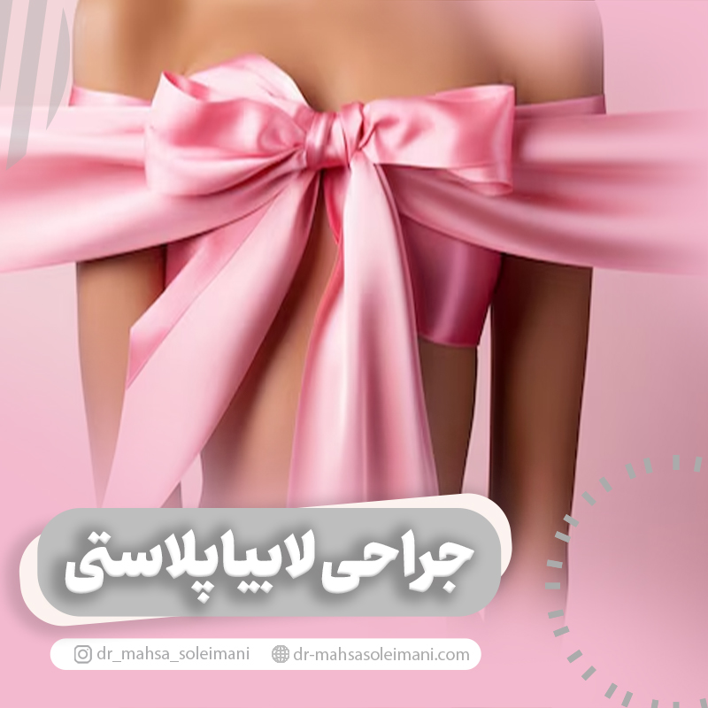 جراحی لابیاپلاستی