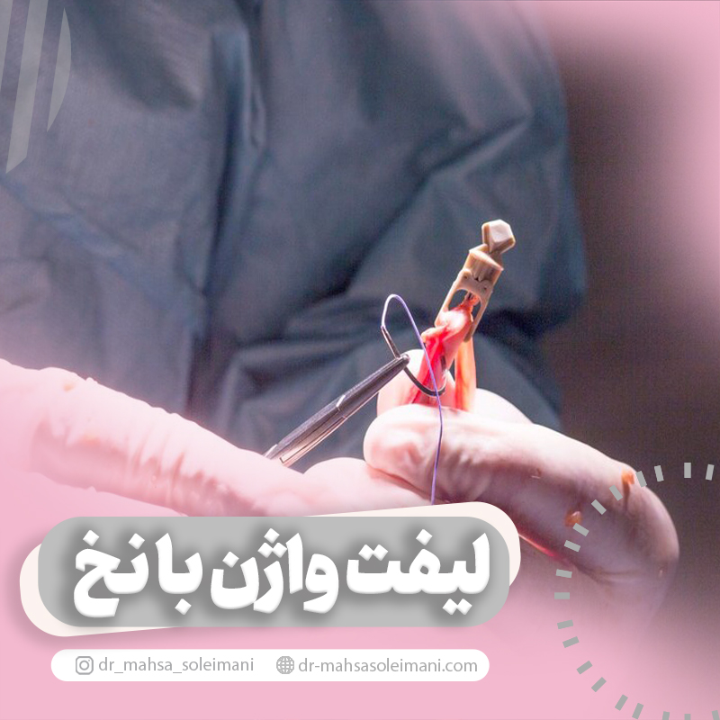 لیفت واژن با نخ