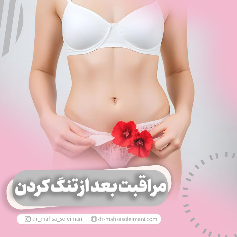 مراقبت های بعد از تنگ کردن واژن
