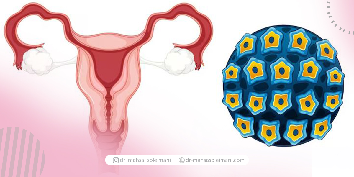 روند تشخیص ویروس HPV