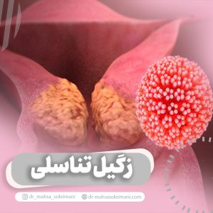 زگیل تناسلی چیست؟